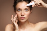 Methods to eliminate acne – get rid of it once and for all!